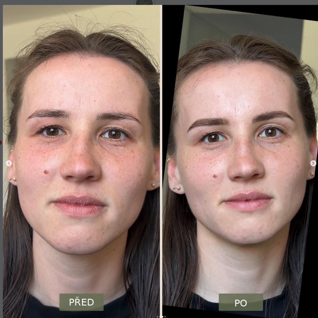 Úprava obočí – před a po, ESMÉ Atelier